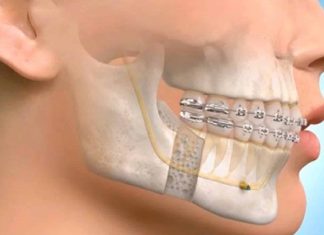 The Decision-Making Process Behind Complex Jaw Treatment Maxillofacial Surgeon