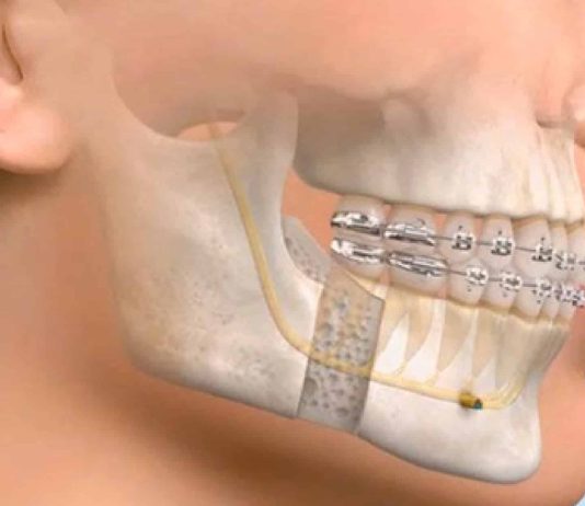 The Decision-Making Process Behind Complex Jaw Treatment Maxillofacial Surgeon
