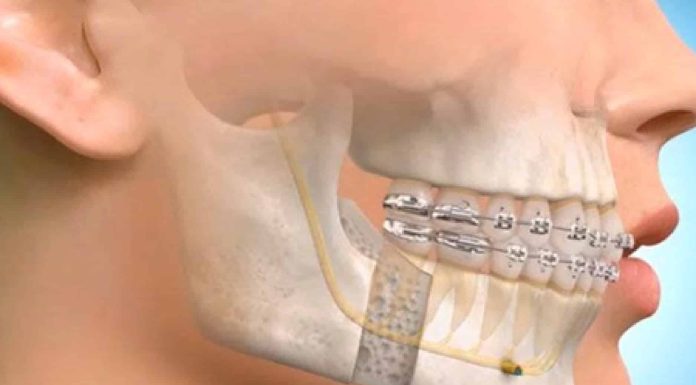 The Decision-Making Process Behind Complex Jaw Treatment Maxillofacial Surgeon