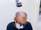 Surgical Periodontal Procedures: Benefits, Recovery & Results gum grafting