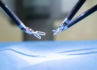Da Vinci (Single Port) Robotic Surgery: A New Era in Minimally Invasive Procedures Da Vinci (Single Port) Robotic Surgery