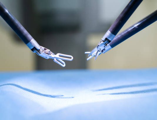 Da Vinci (Single Port) Robotic Surgery: A New Era in Minimally Invasive Procedures Da Vinci (Single Port) Robotic Surgery