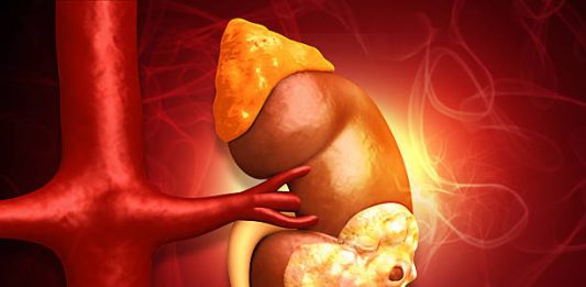 Kidney Cancer: Symptoms, Causes, Diagnosis, Treatment, and Prevention Kidney Cancer
