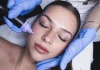 Edmonton Guide to Precision Microneedling Edmonton Aesthetic Clinic