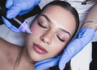 Edmonton Guide to Precision Microneedling Edmonton Aesthetic Clinic